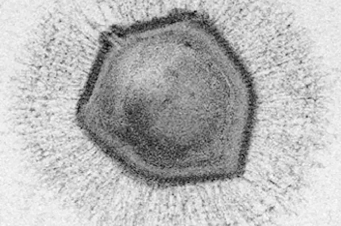 Sorpresa microscópica: los virus gigantes