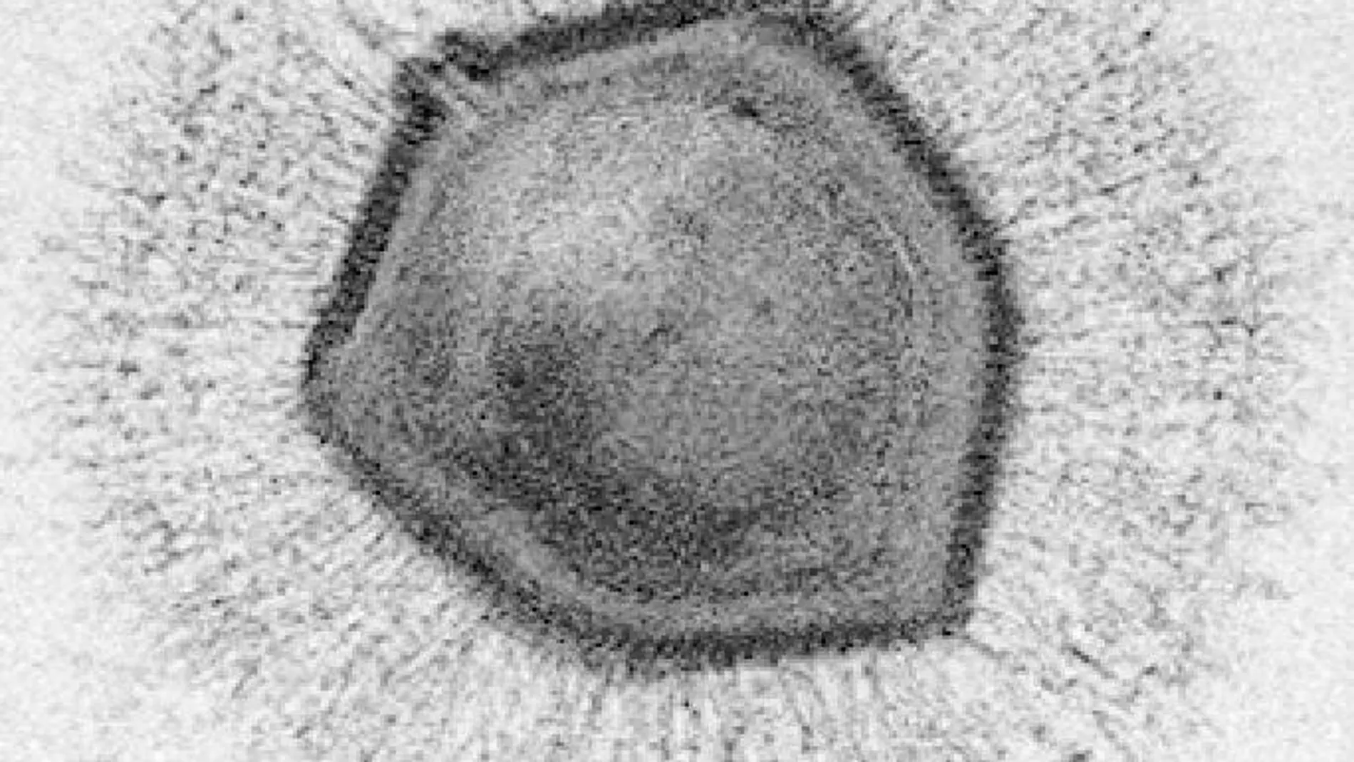 Una imagen del virus gigante Mimivirus, en la que se aprecia que su tamaño es comparable al de una bacteria.