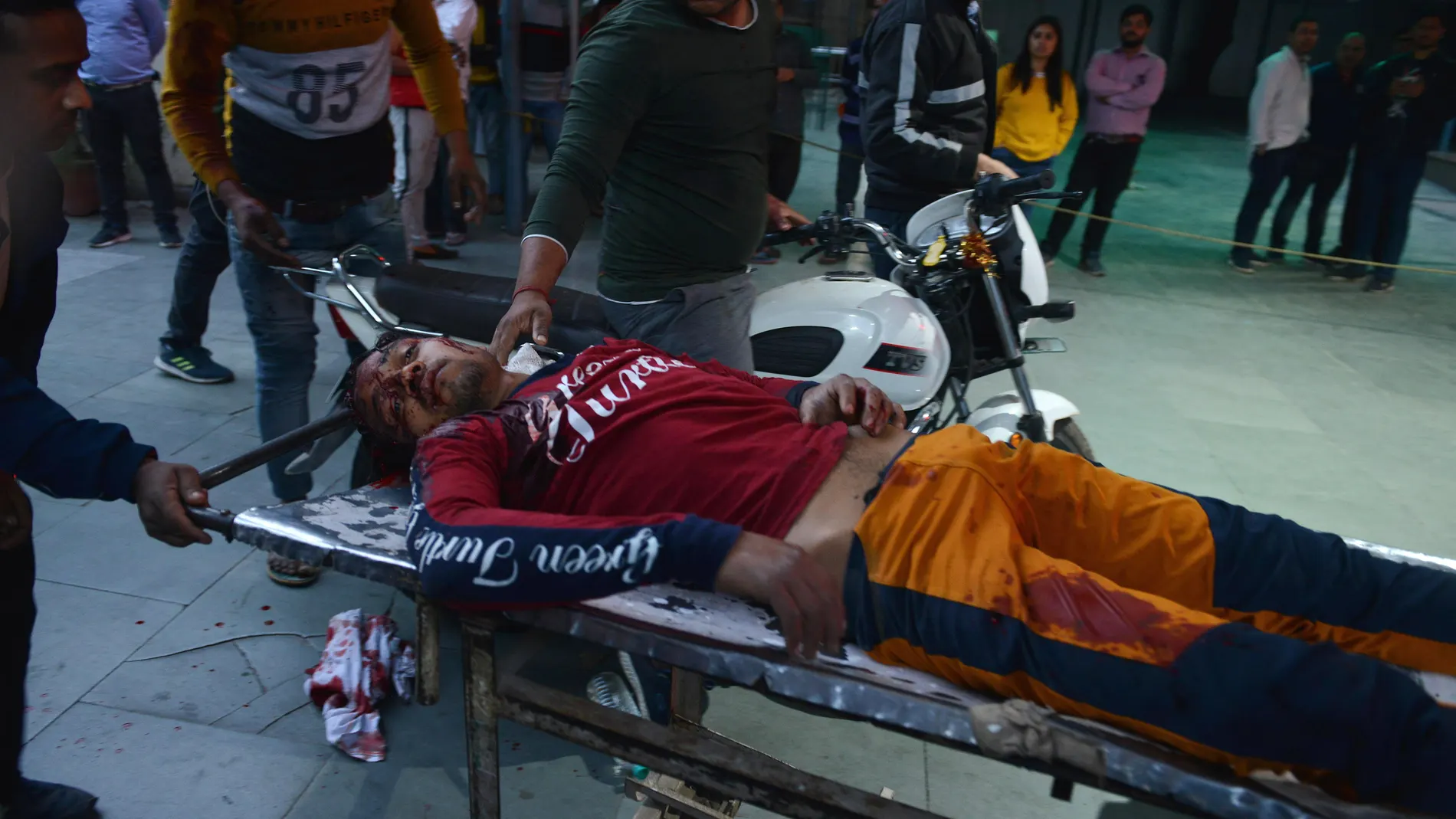 Uno de los heridos en los enfrentamientos registrados en Nueva Delhi