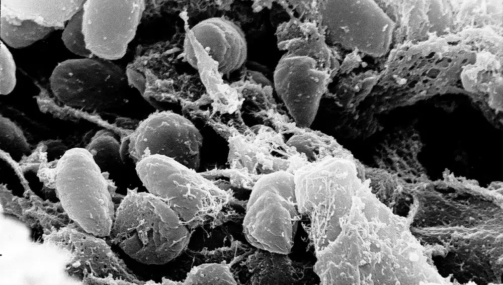 Vista con microscopio de la bacteria causante de la peste.