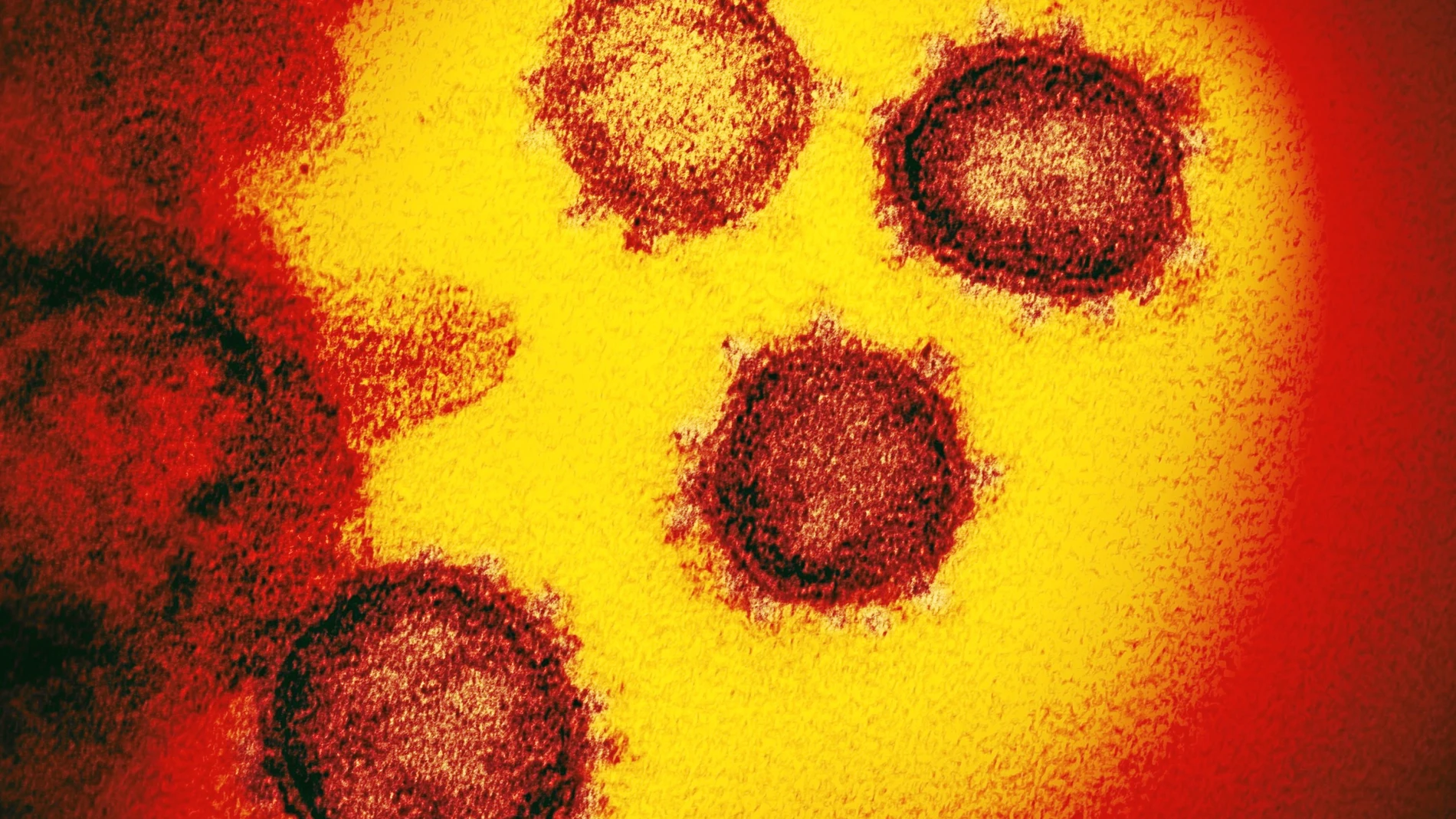 Imagen del virus que está causando la Covid-19