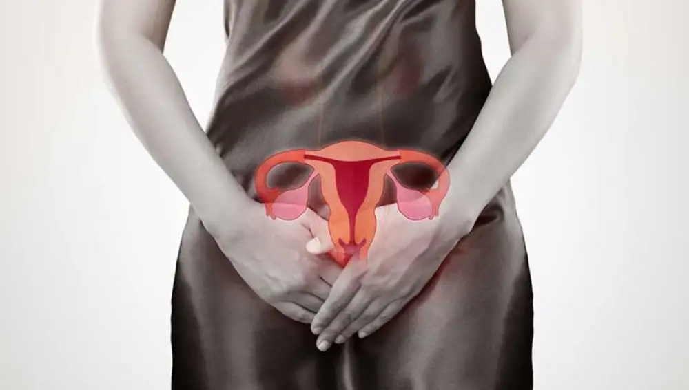 Fuertes dolores pélvicos, fatiga o sangrados entre períodos son algunos de los síntomas de la endometriosis
