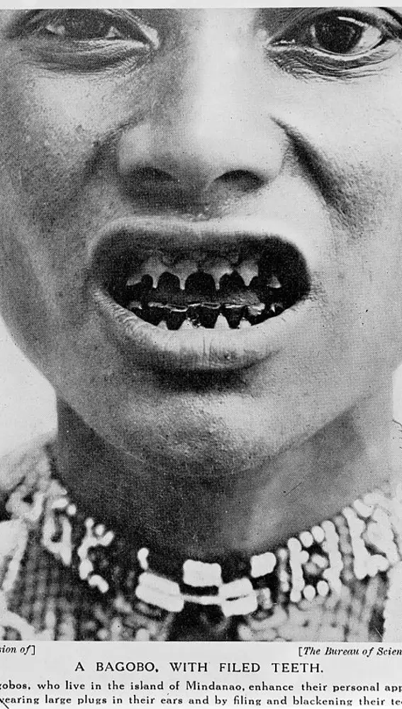 Tribus africanas, incluso individuos occidentales, siguen practicando el limado de dientes.