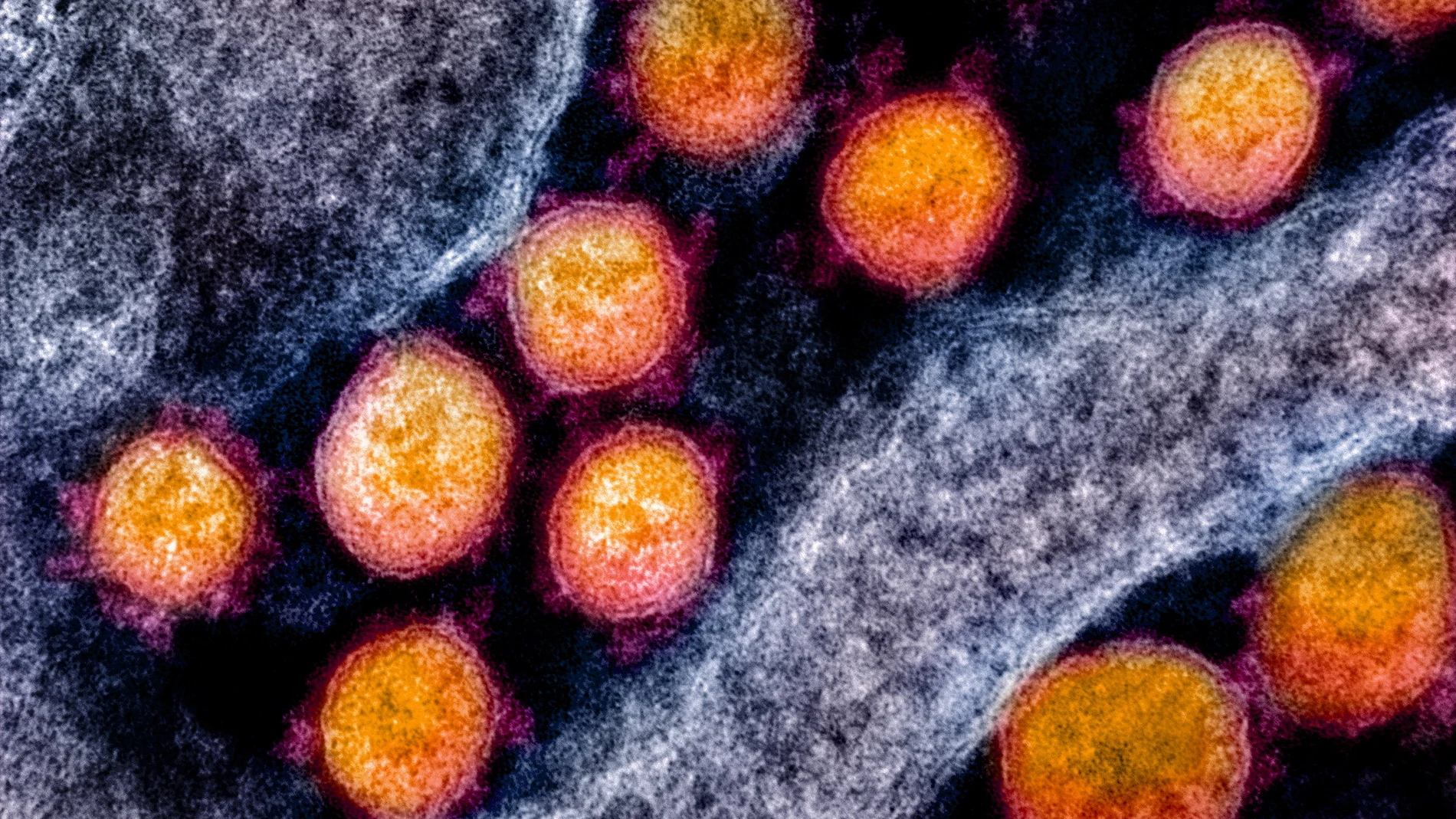 Research on novel coronavirus 2019, National Institutes of Health