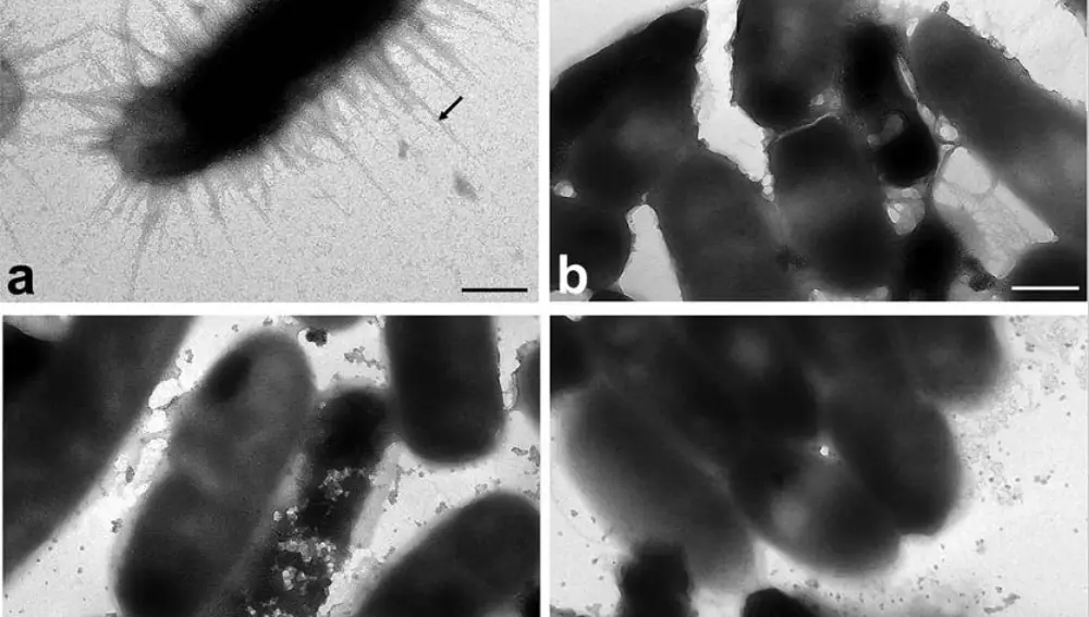 Bacterias de E. Coli previas a un tratamiento con una solución de iones de plata a 0,2 ppm (a) y su posterior desarrollo (b, c, d).