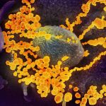 Imagen tomada por un microscopio electrónico de multitud de SARS-CoV-2 (dorado) emergiendo de una célula infectada. (Imagen coloreada artificialmente)