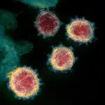  ¿Cómo entra el coronavirus en tus células?