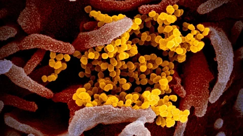 Imagen de microoscopía electrónica del SARS-CoV-2 (Hecha en el Rocky Mountain Laboratories)