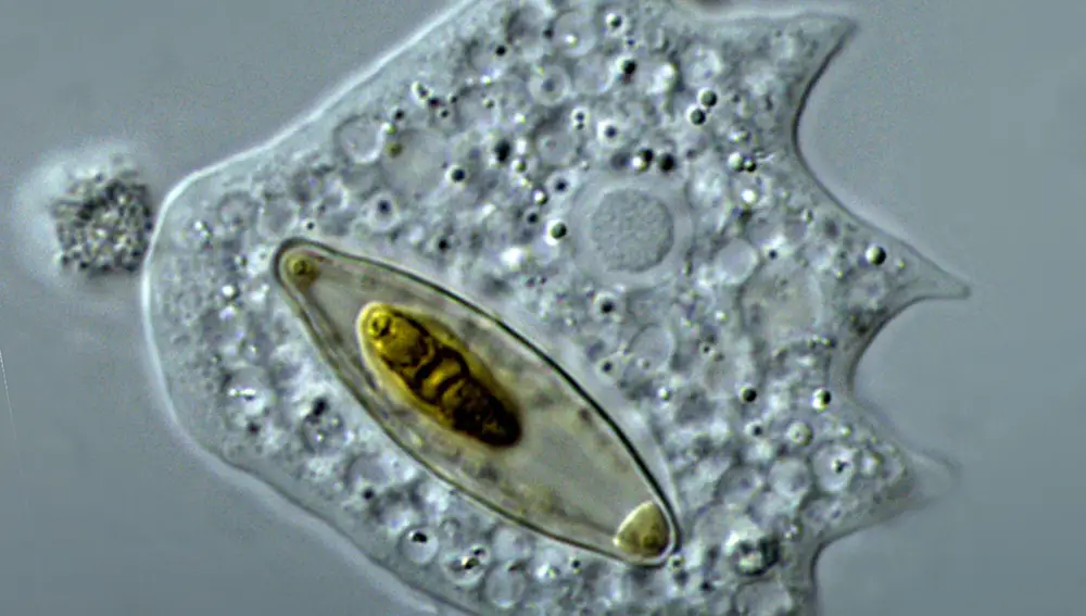 Una ameba del género Mayorella.