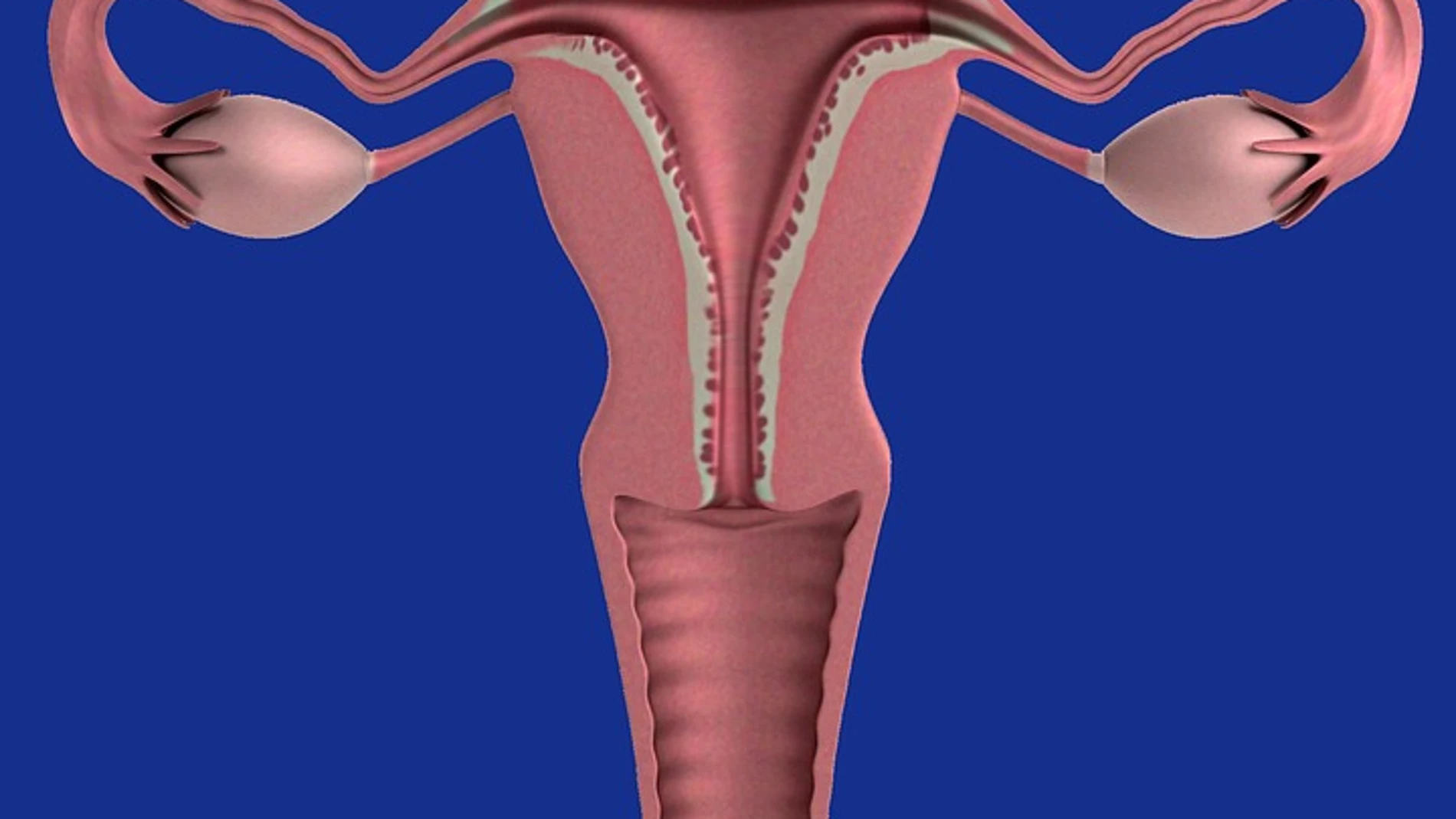 El hiperandrogenismo ovárico funcional, más conocido como síndrome de ovarios poliquísticos (SOP), es un desorden hormonal provocado por una alteración de la función ovárica.