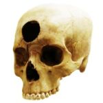 Cráneo trepanado encontrado en Nazca, Perú. No hemos podido confirmar la veracidad de la pieza y aunque la ubicación del drenaje es atípico, el tamaño y el aspecto de sus bordes tienen precedente en la cultura peruana precolombina.