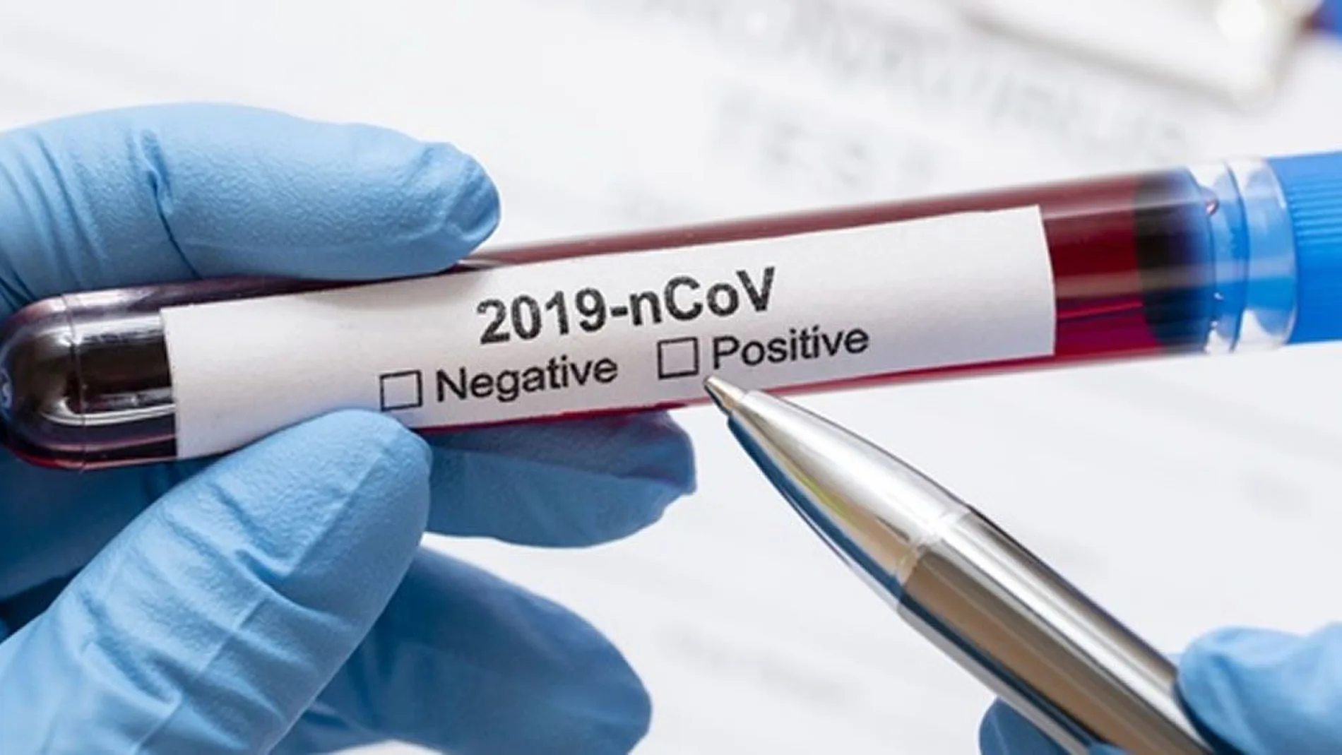 El nuevo sistema permitirá conocer más rápidamente si los pacientes están contagiados por coronavirus