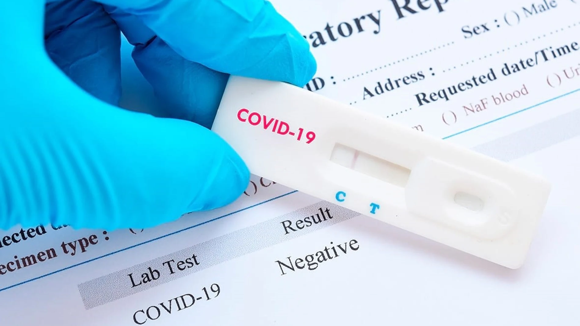 Coronavirus.- La Diputación de Barcelona distribuye kits de detección rápida a los ayuntamientos