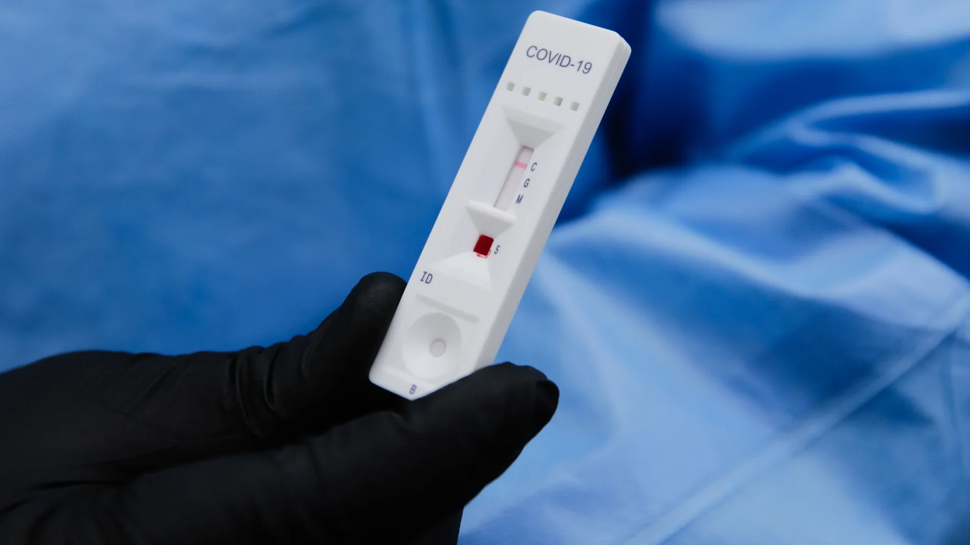 Mientras los PCR detectan el material genético del virus, los test rápidos, los anticuerpos