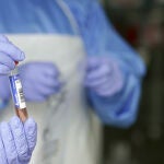 Un sanitario protegido con guantes sostiene un muestra para realizar un Análisis PCR