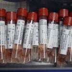 El Ayuntamiento realizará PCR al ser más fiable que el test rápido