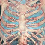 Imagen de los efectos en los pulmones del coronavirus