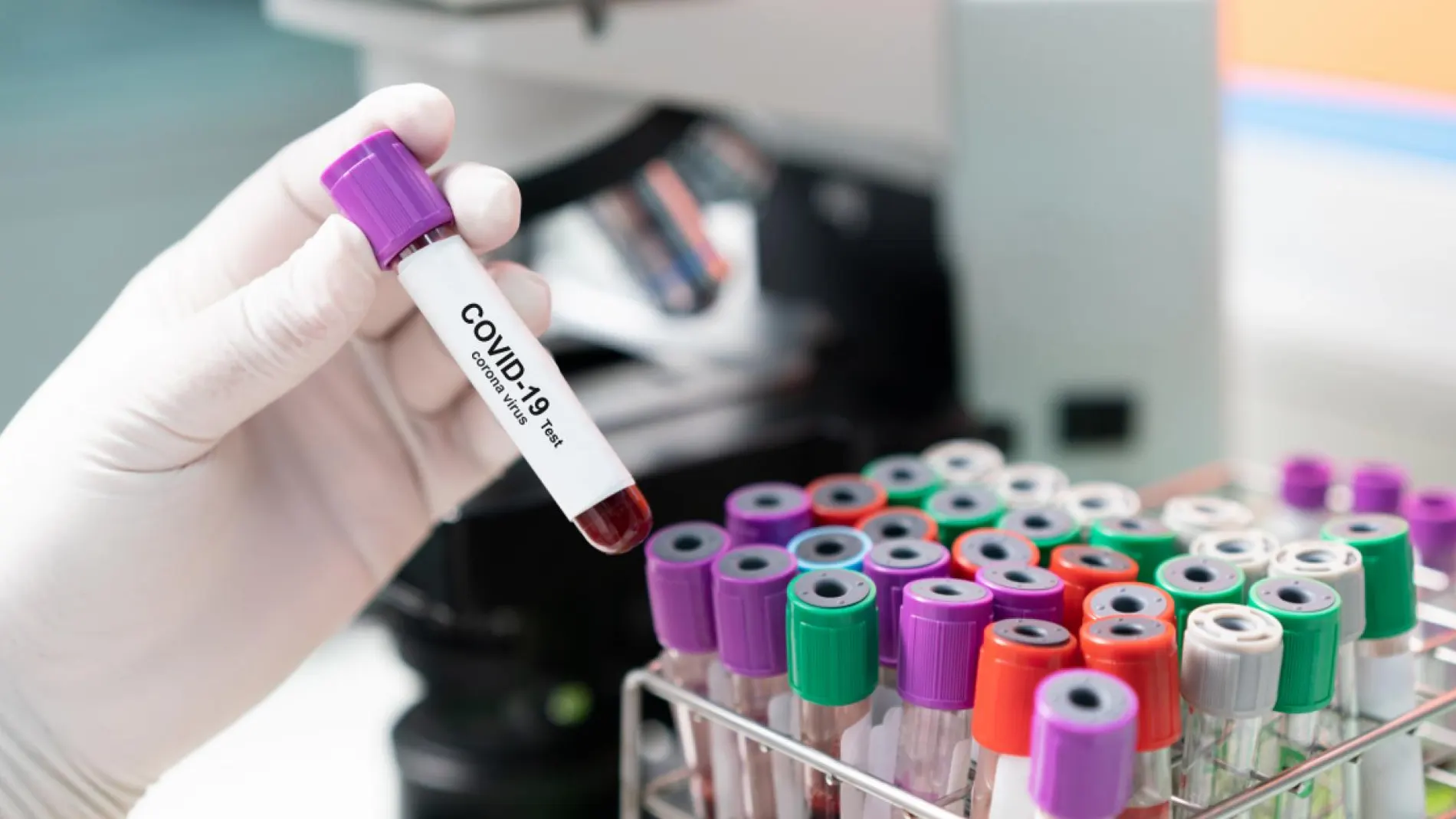 Coronavirus: Test de detección del SARS-CoV2 (covid-19)