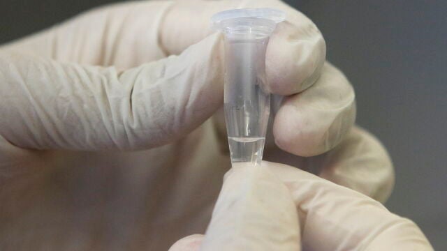 Durante la primera semana, en la que el paciente puede mostrar síntomas como fiebre y tos, se recomienda el uso de pruebas genéticas PCR