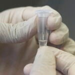Durante la primera semana, en la que el paciente puede mostrar síntomas como fiebre y tos, se recomienda el uso de pruebas genéticas PCR