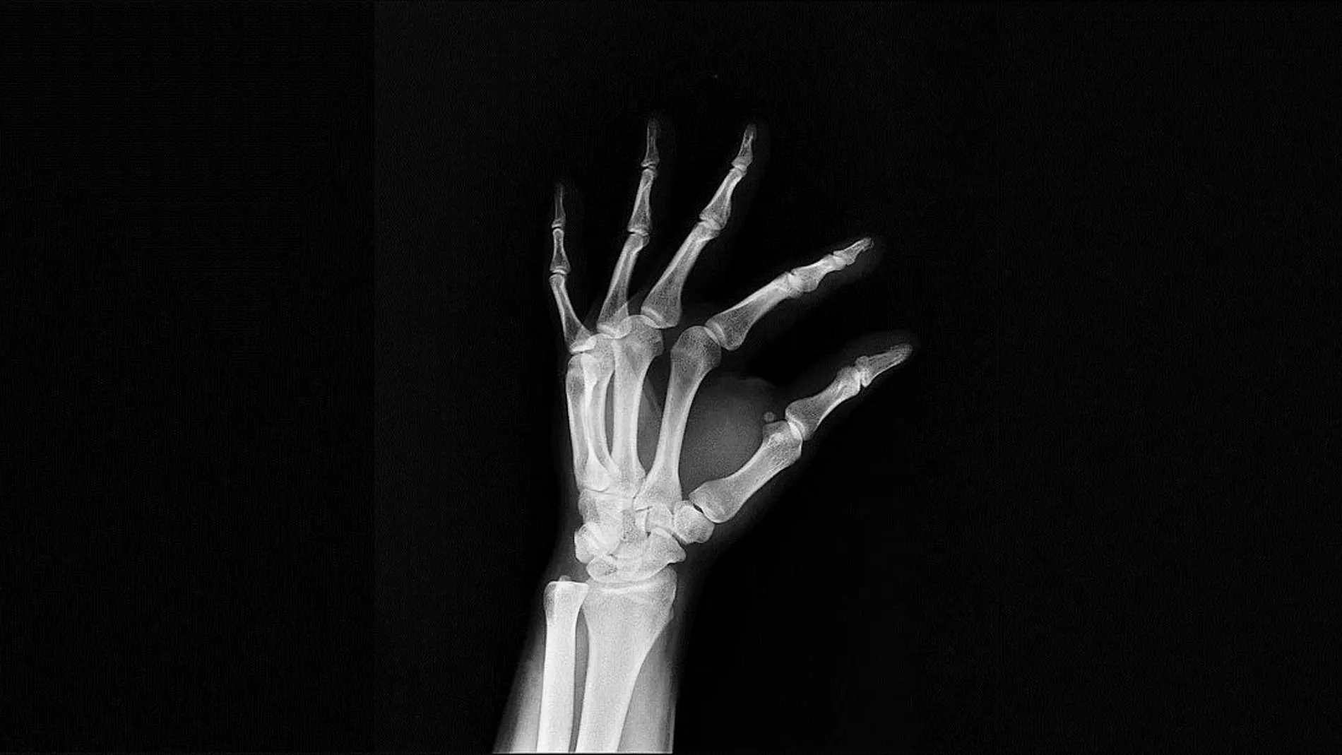 Radiografía de una pRadiografía de una mano (en principio derecha) de una página de stockágina de stock