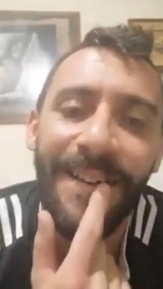 Álvaro Fernández muestra su diente roto tras la agresión