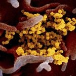 Imagen de laboratorio del virus SARS-CoV-2.