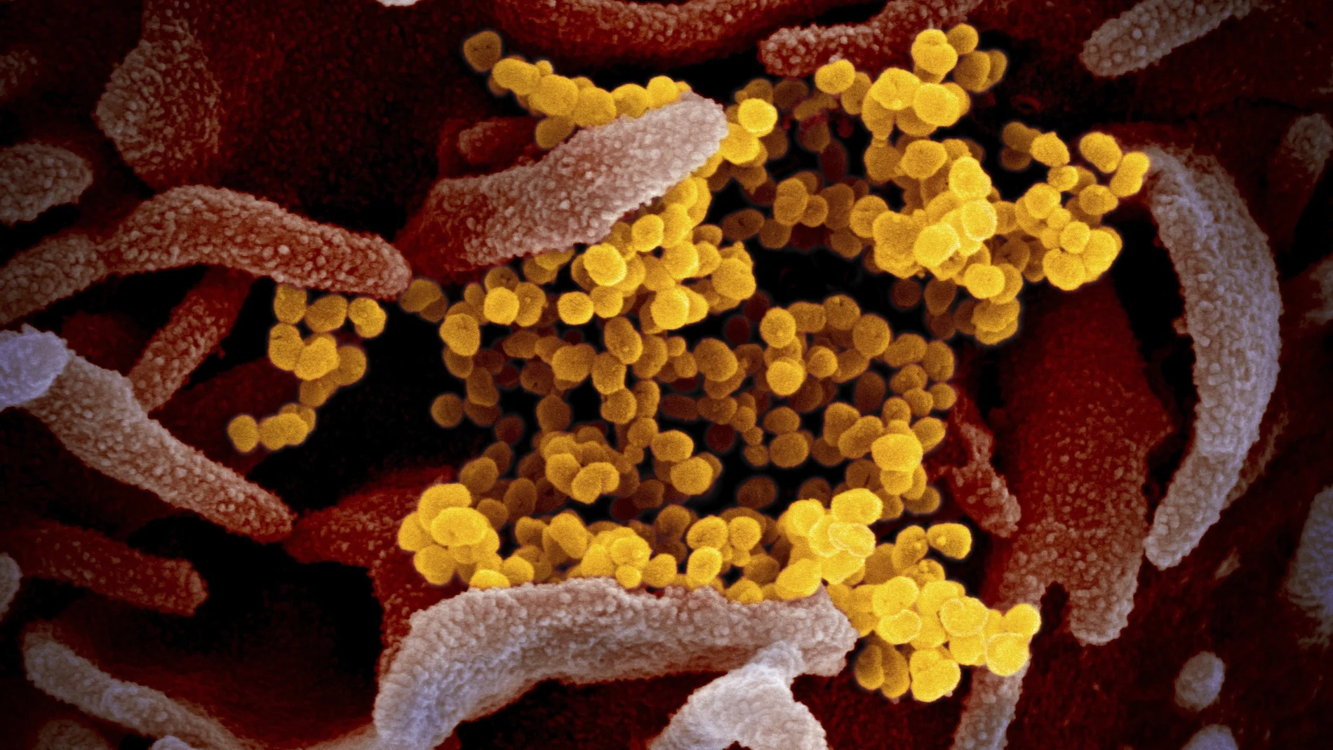 Imagen de laboratorio del virus SARS-CoV-2.