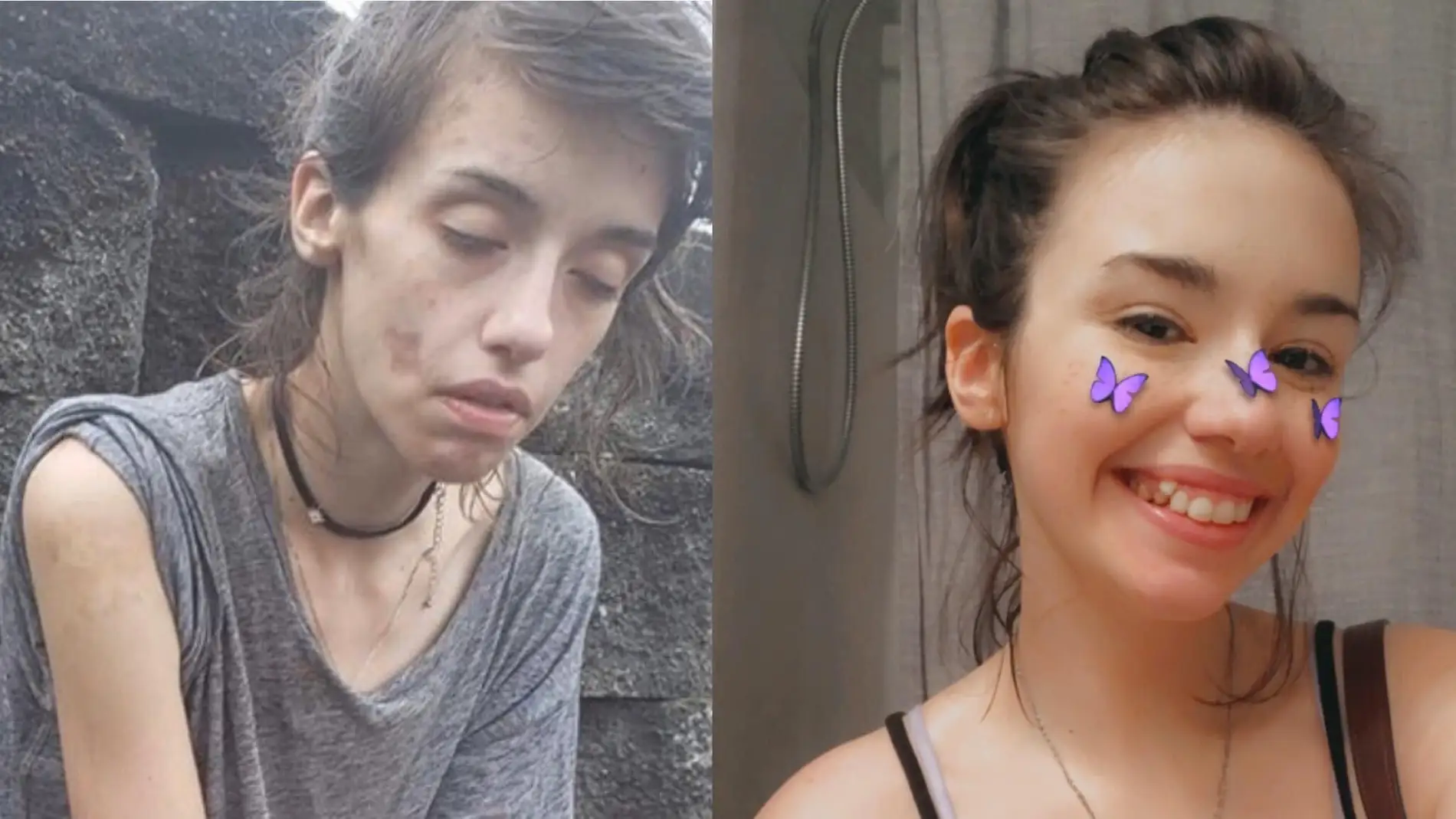 El increíble cambio de Amber Hoffman tras superar su adicción a las drogas