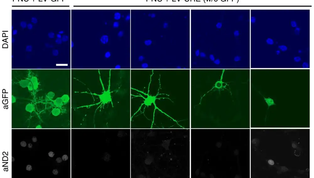 Imagen mostrando la pérdida de prolongaciones en las neuronas. Del artículo: KAT3-dependent acetylation of cell type-specific genes maintains neuronal identity in the adult mouse brain.