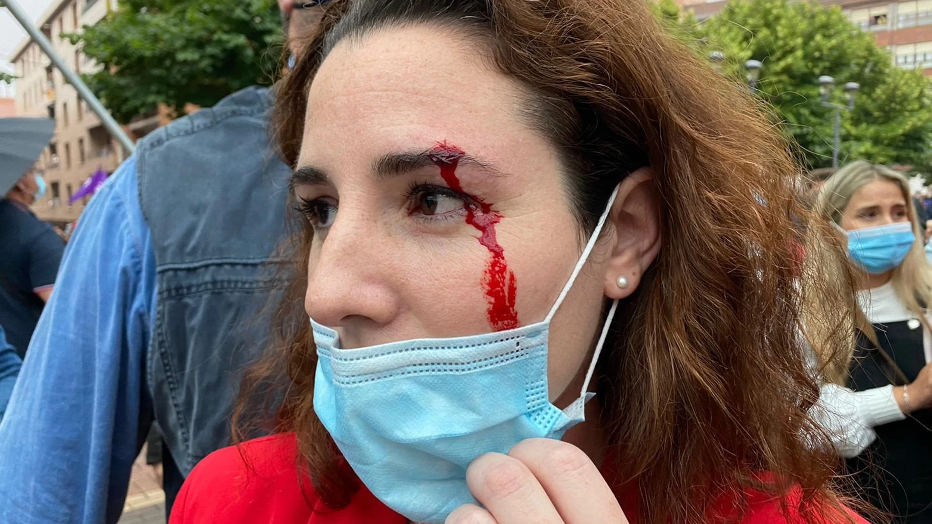 La diputada de Vox Rocío de Meer sangrando de una ceja tras recibir una pedrada en Sestao (Bizkaia)VOX26/06/2020