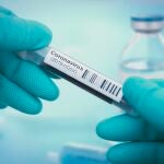 Test de coronavirus