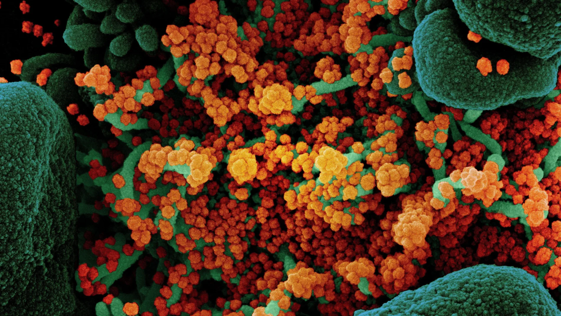 Imagen del virus SARS-COV-2