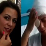 Ana Mari antes y después de que su pareja la rociase con ácido.