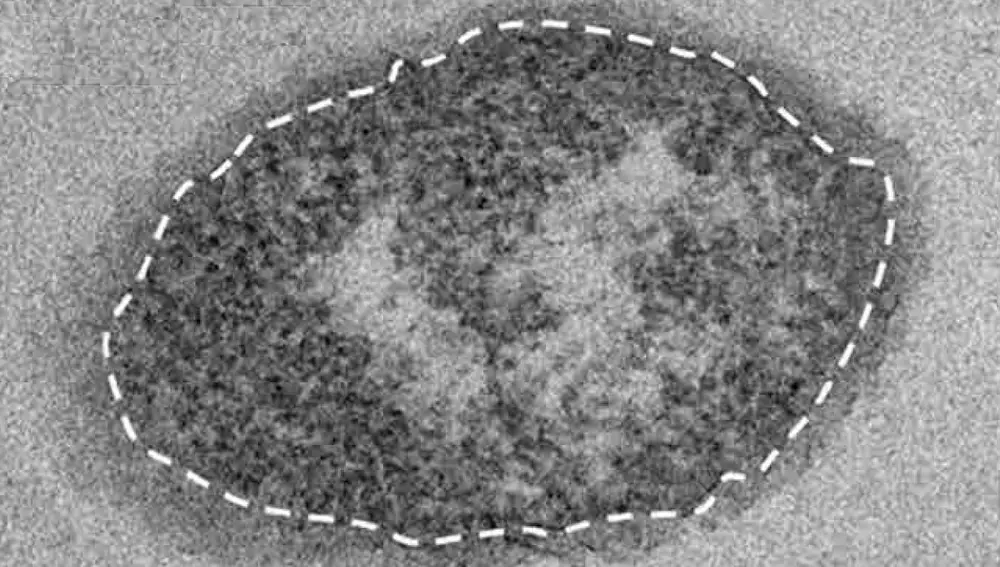 Imagen de microscopio electrónico de un individuo de Staphylococcus aureus expuesto a HDMP in vitro. La línea discontinua blanca señala la posición de la pared celular, es decir, el límite exterior de la célula de S. aureus. Se observa claramente alrededor de la célula una “corona” de fibras de HDMP. La barra blanca de abajo a la derecha mide 0,2 micras.