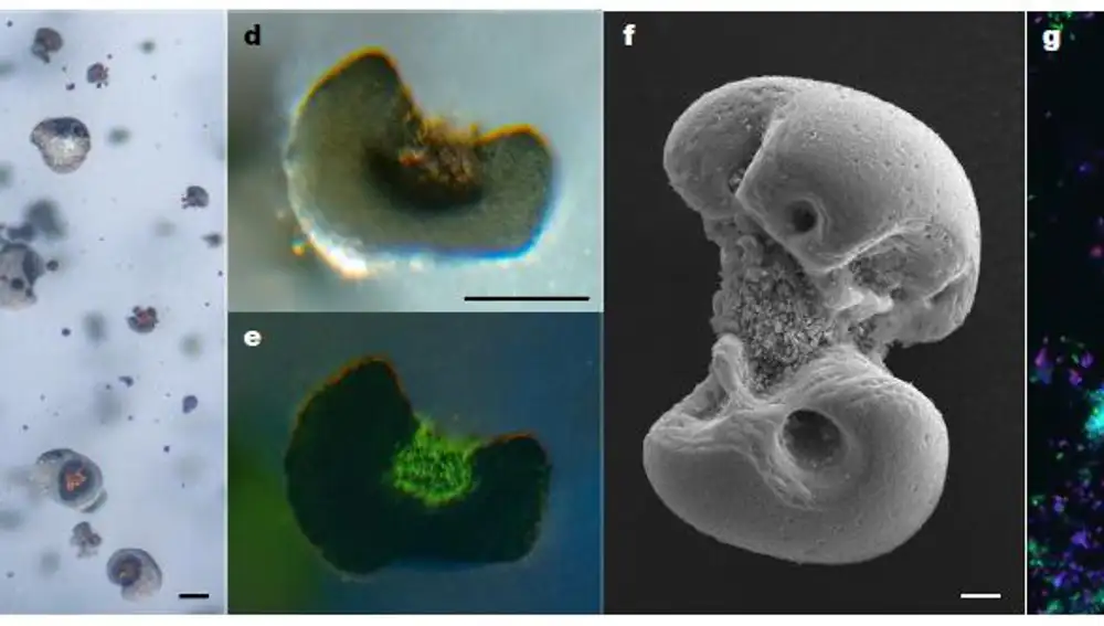 Distintas vistas de los micronódulos de manganeso precipitados por las bacterias del estudio