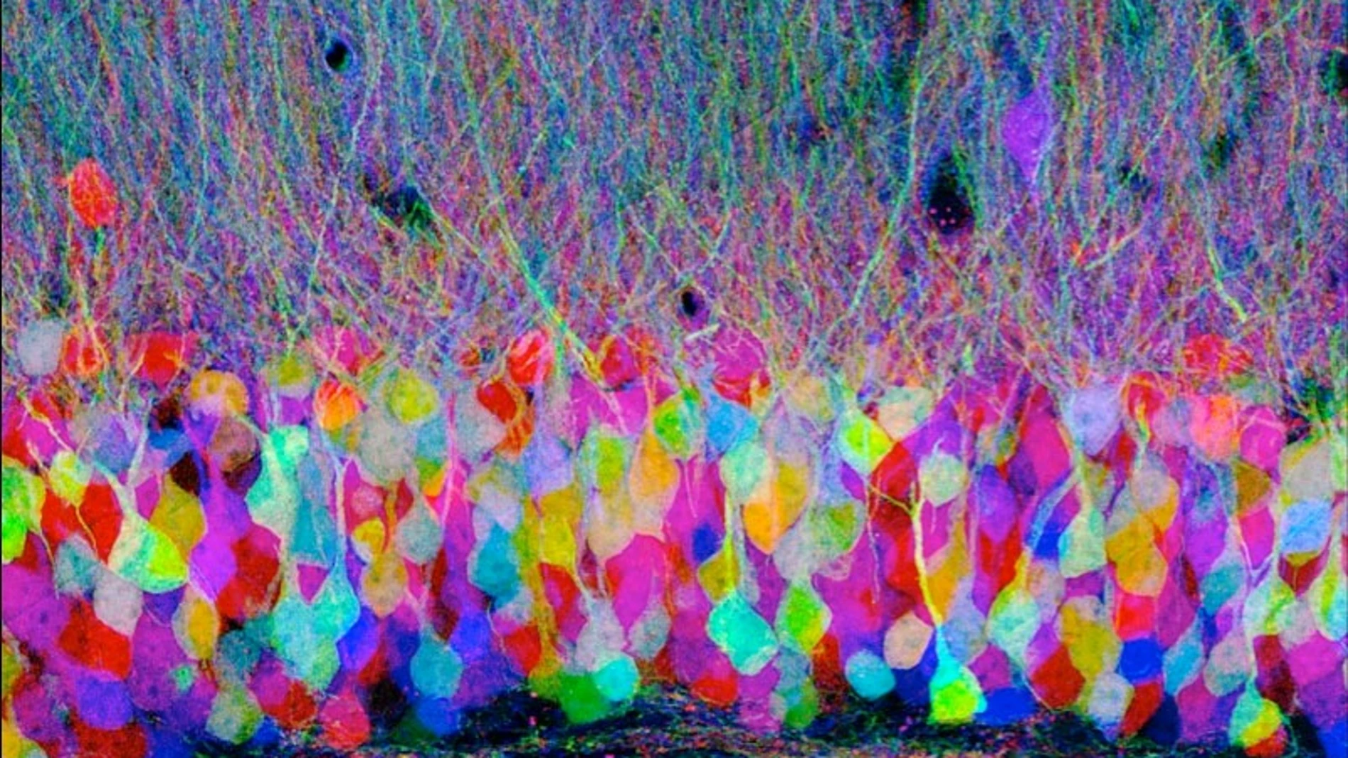 Corte histológico de un cerebro mostrando las distintas neuronas con tinciones inmunofluorescentes en lo que se conoce como brainbow. No es una imagen relacionada con este estudio.