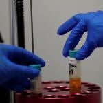 Hasta el momento, 82 niños menores de cinco años han sido diagnosticados entre mayo y julio de 2022