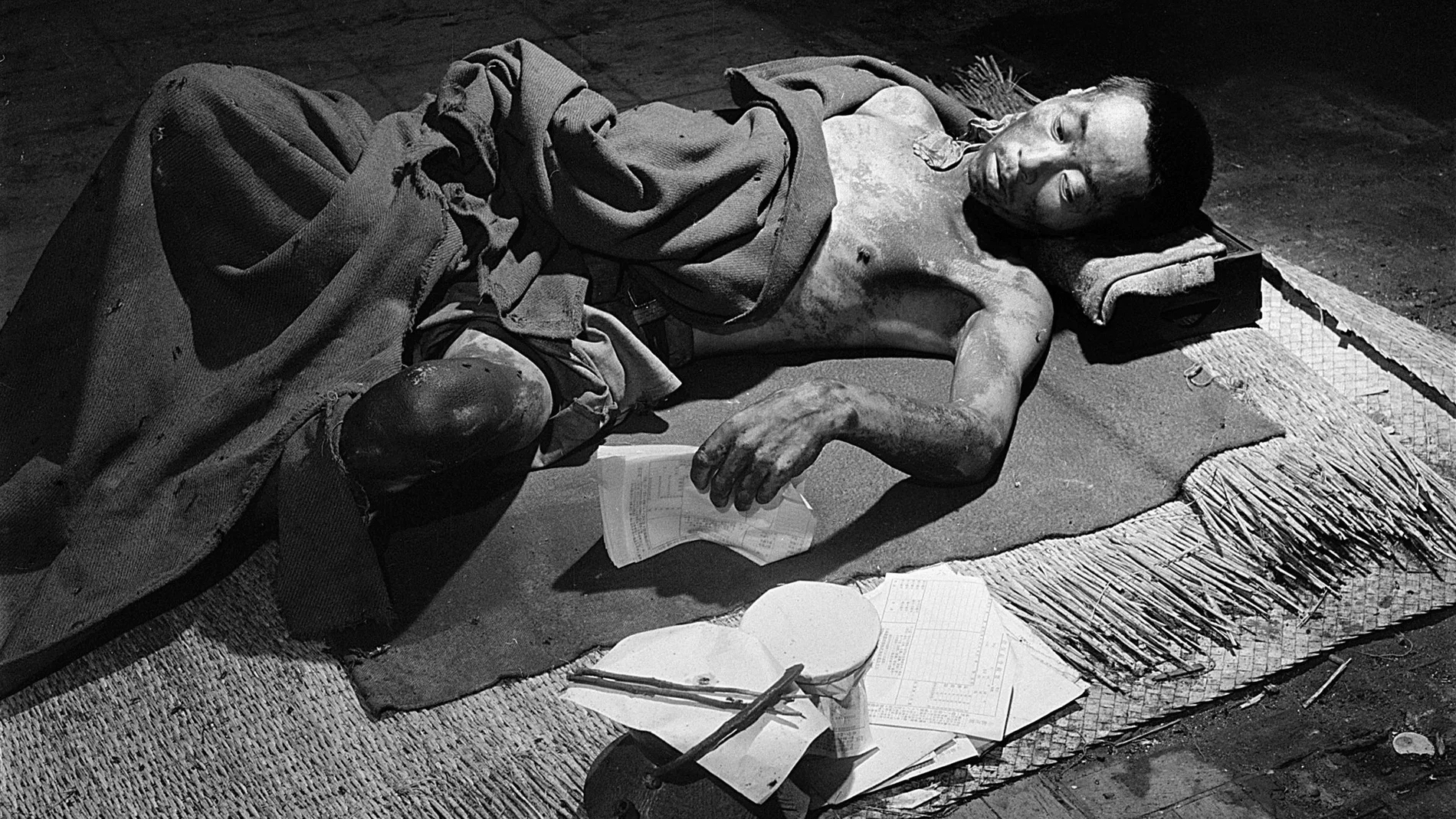 Uno de las víctimas del ataque de Hiroshima
