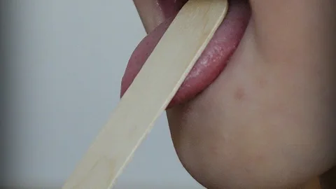 Los síntomas de una amigdalitis pueden confundirse con los del coronavirus