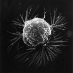 Célula de cáncer de mama fotografiada con un microscopio electrónico.