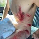 Ángel Madrazo, con el cuerpo destrozado tras su caída en la Settimana Internazionale Coppi e Bartali