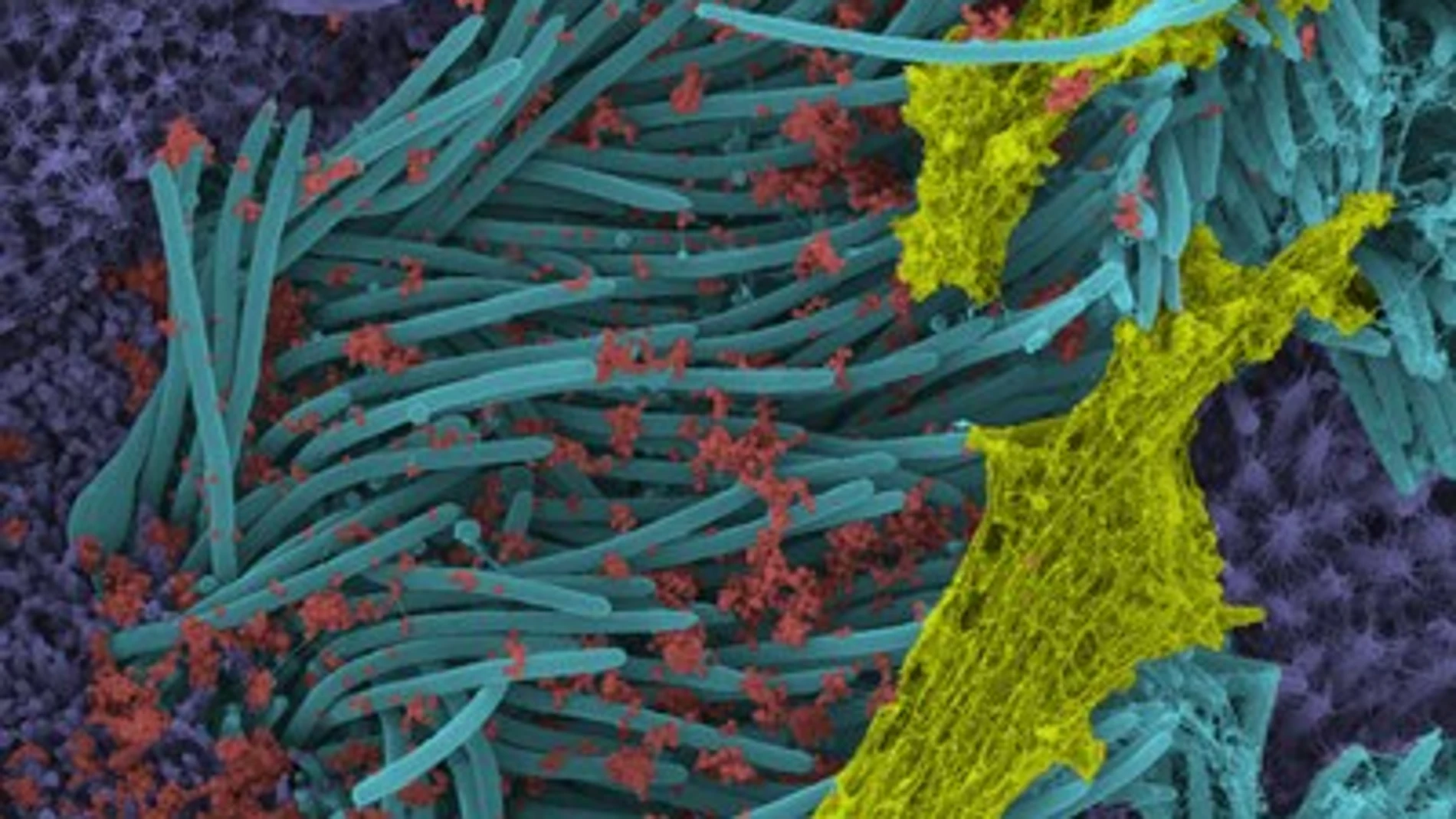 Las partículas de coronavirus, en rojo, infectan el sistema respiratorio. UNC SCHOOL OF MEDICINE