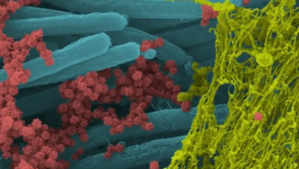 Estructura de las partículas de coronavirus, en rojo