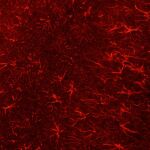 Células de la glía de una rata teñidas con anticuerpos anti-GFAP tomadas por el Orchinik Lab, Arizona State University