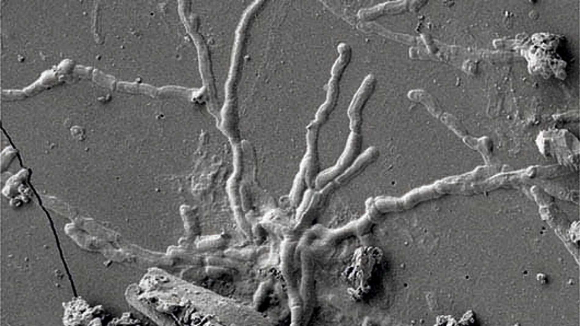 Estructuras semejantes a neuronas preservadas en una presunta muestra de tejido cerebral vitrificado. CEINGE (Foto de ARCHIVO)29/07/2020