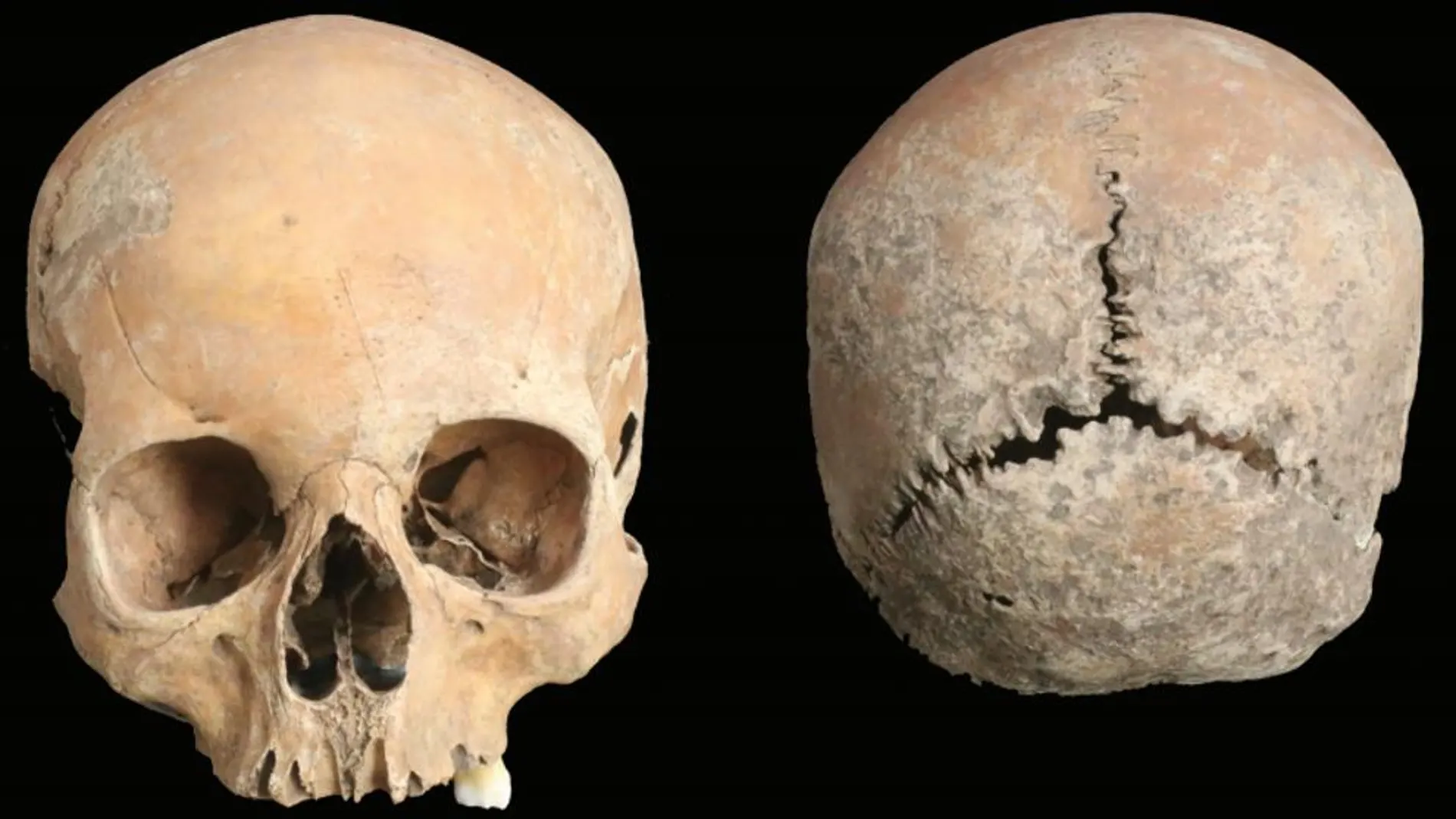 Cráneo de una joven de entre 15 y 18 años