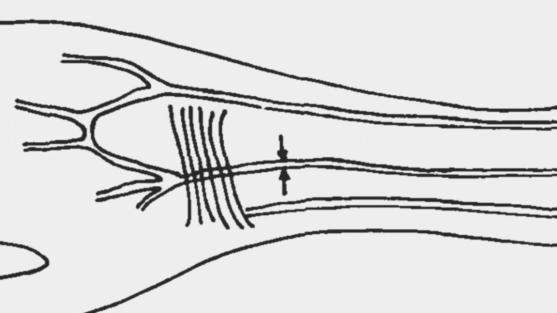 Descripción de la arteria mediana en el antebrazo