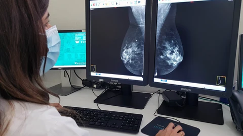 La esperanza de vida de una paciente con metástasis es de 4 o 5 años