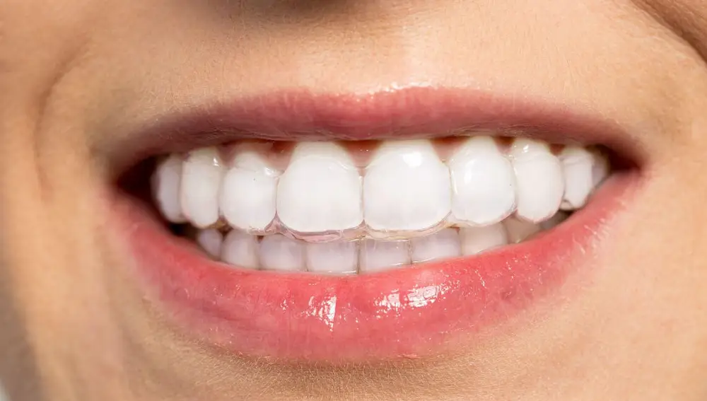 La ortodoncia invisible puede realizarse en una amplia gama de situaciones clínicas.